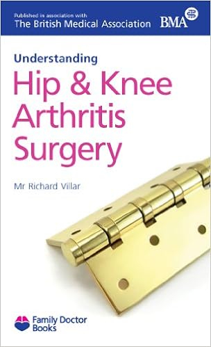 Understanding Hip and Knee Arthritis Surgery (Family Doctor Series)